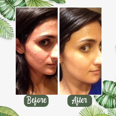 Mascarilla facial de té verde!