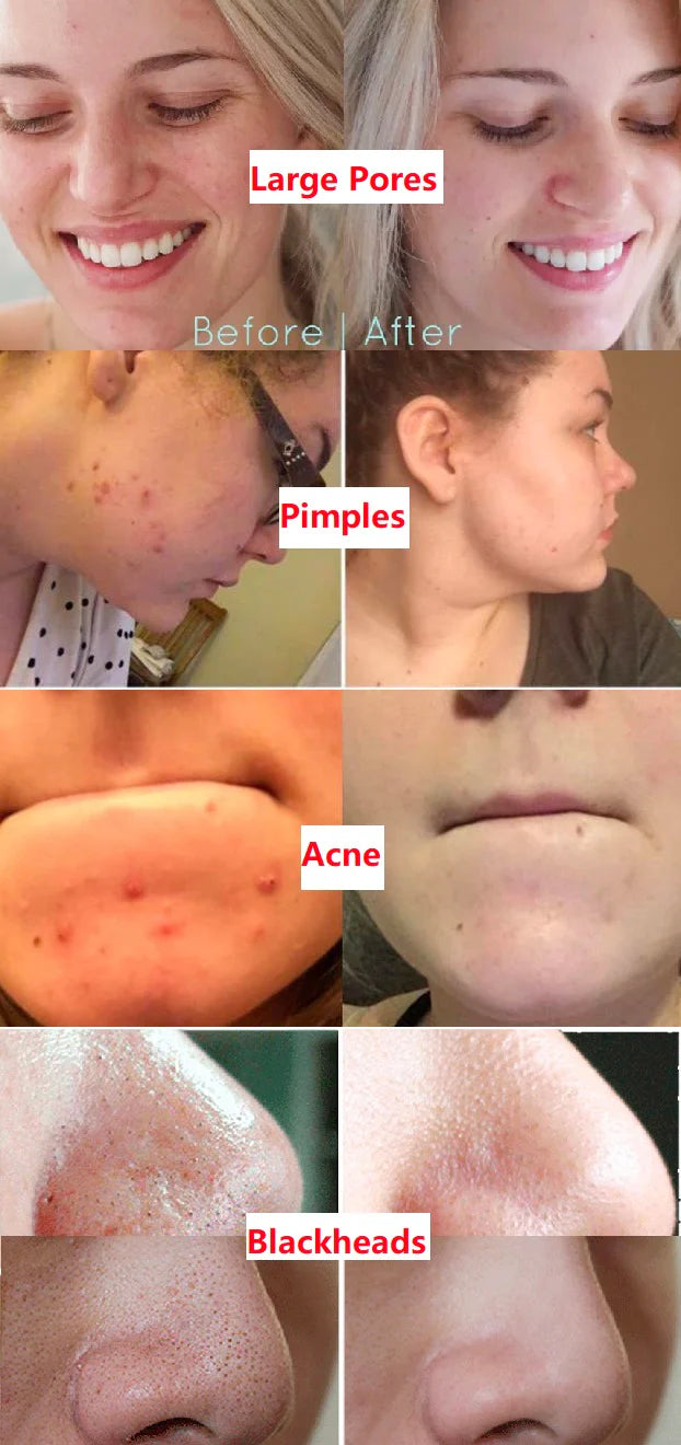 Mascarilla facial de té verde!